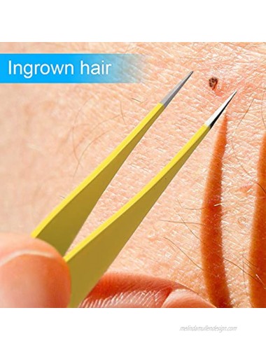 Ingrown Hair Tweezers Premium Stainless Steel Sharp Tweezers for Ingrown Hair Splinters Ticks and Glass Removal