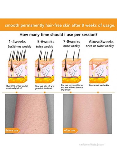 Hair Removal Device IPL Permanent Automatic Mode Painless Hair Remover for Women and Man UPGRADE to 999,900 Flashes for Armpits Face Arms Bikini Line Back Legs Professional Hair Treatment Home Use